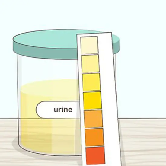 mercury, random urine
